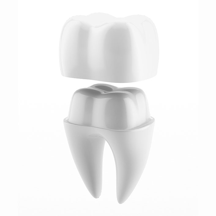 Same-Day Crown Technology - Dental Technology